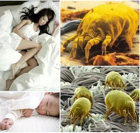 福州人每天600万螨虫陪你入睡，再不清除床上的螨虫，小心得病