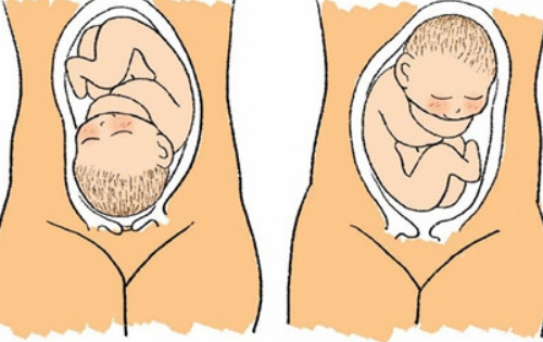 胎兒左枕橫位是什麼意思左枕橫位寶寶會入盆嗎